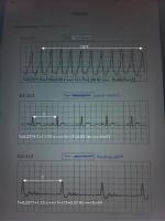 post-24224-0-80249700-1410120379_thumb.j