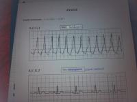 post-74988-0-42293300-1410118602_thumb.j